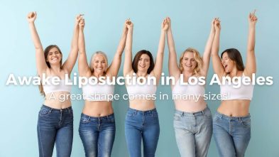 Awake Liposuction in Los Angeles