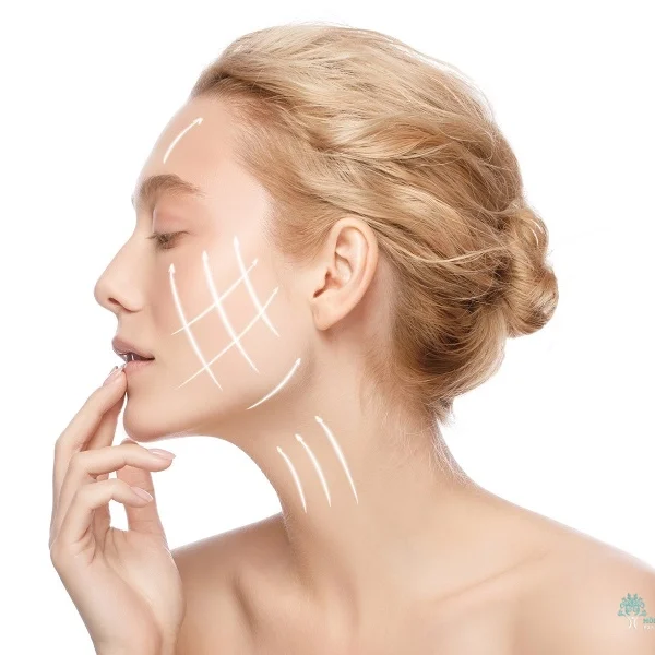 Neck Lift and Lower Facelift Recovery Pictures Day by Day
