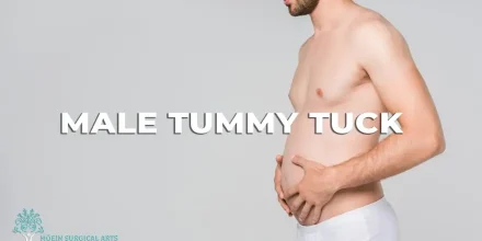 Male Tummy Tuck