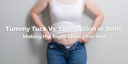 Tummy Tuck Vs. Liposuction or Both: Making the Right Choice For You