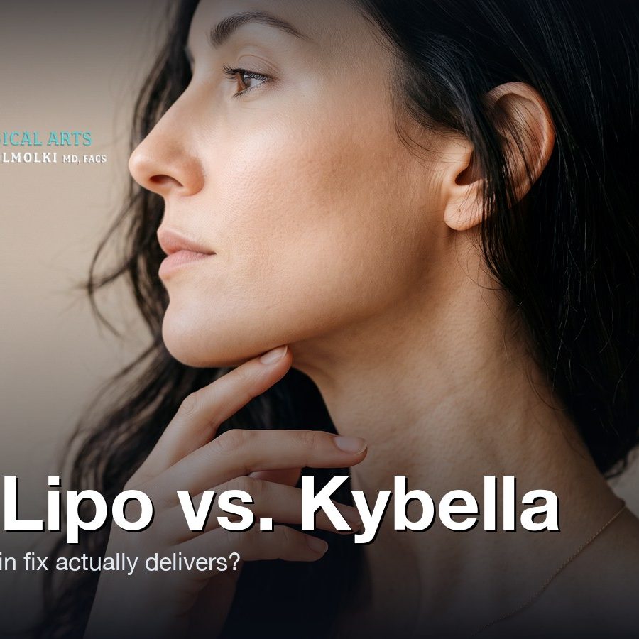 Woman's jawline, chin and neck profile — Chin Lipo vs. Kybella double-chin treatment, Moein Surgical Arts, Los Angeles