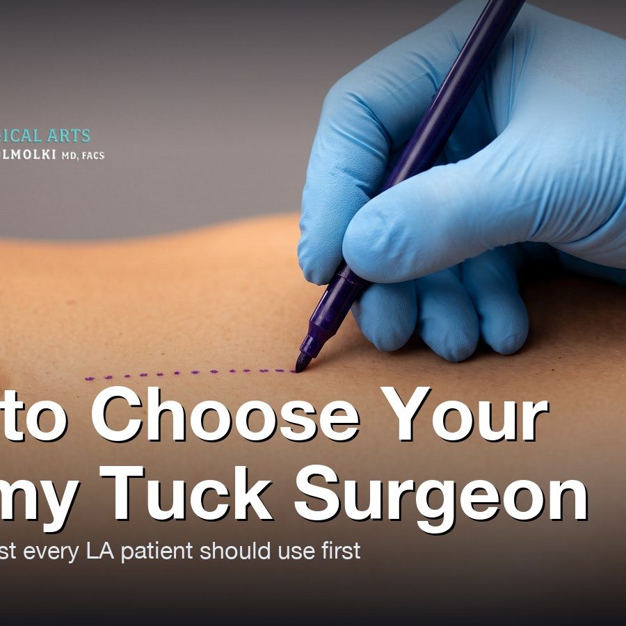 Surgeon's gloved hand marking a tummy tuck guideline on the abdomen — How to Choose Your Tummy Tuck Surgeon, Moein Surgical Arts, Los Angeles