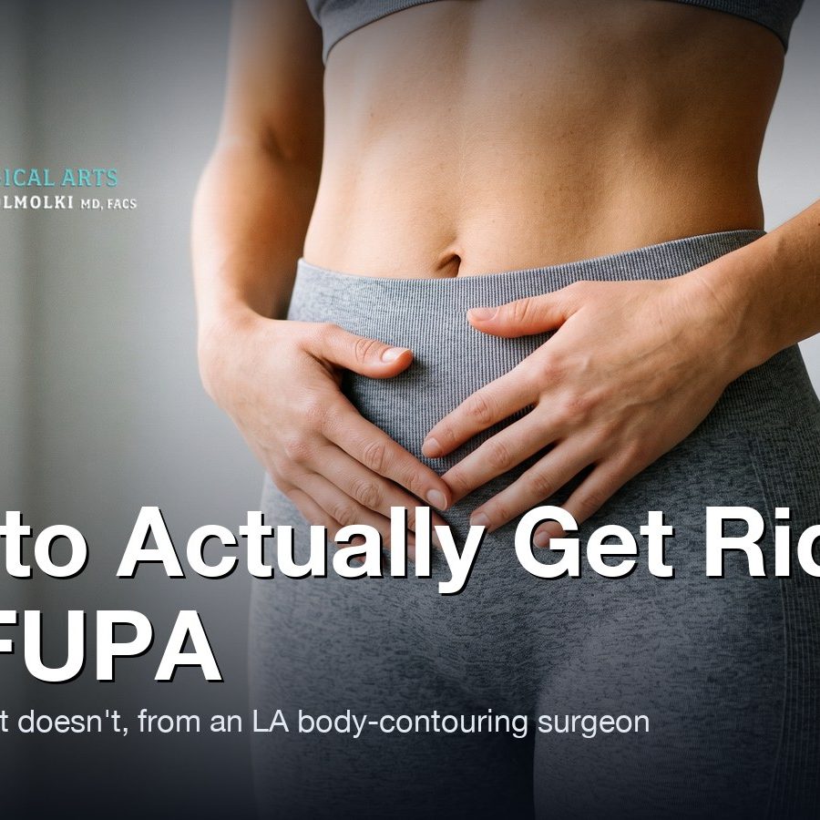 Lower abdomen and waistline in athletic wear — How to Get Rid of a FUPA, Moein Surgical Arts, Los Angeles