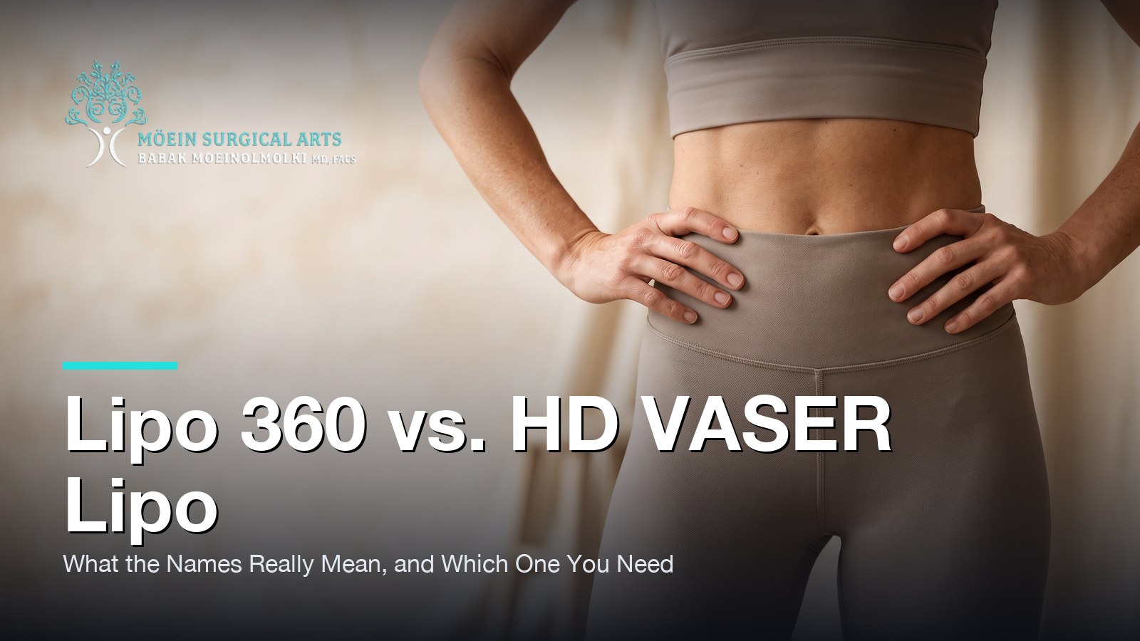 Lipo 360 vs. HD VASER Lipo: What the Names Really Mean — and Which One You Need