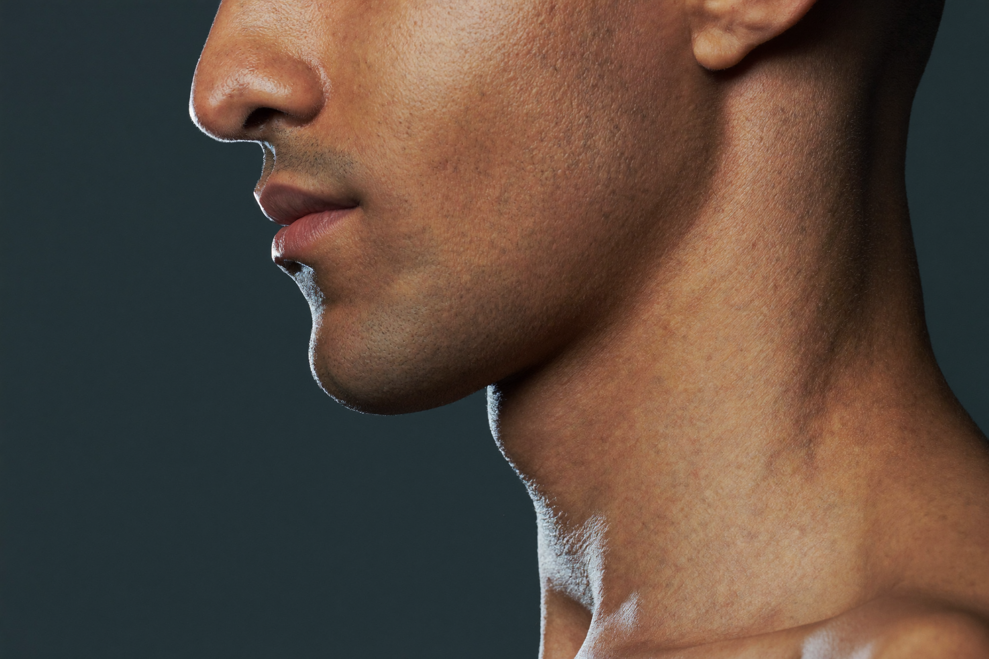 Male profile with weaker chin projection before chin implant in Los Angeles