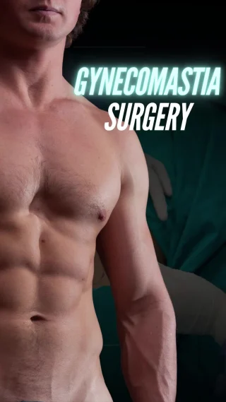 What is Gynecomastia & How is it Treated? 💪✨

In this detailed 3D video, Dr. Moein explains gynecomastia — a condition where excess fat and glandular tissue cause the male chest to look enlarged or feminine. Gynecomastia surgery, also known as male breast reduction, restores a firmer, more masculine chest.

🔹 In the 3D walkthrough, you’ll see:
 – How the chest is marked for treatment
 – Small, discreet incisions created along natural lines
 – Use of liposuction to remove excess fat
 – Precise excision of glandular tissue for a flatter contour
 – How the chest is sculpted into a natural, balanced shape

This procedure can be performed under local anesthesia with sedation or general anesthesia. With advanced techniques, Dr. Moein creates smooth, natural-looking results that give men back their confidence.

📲 DM us “CHEST” to learn more or schedule your consultation.