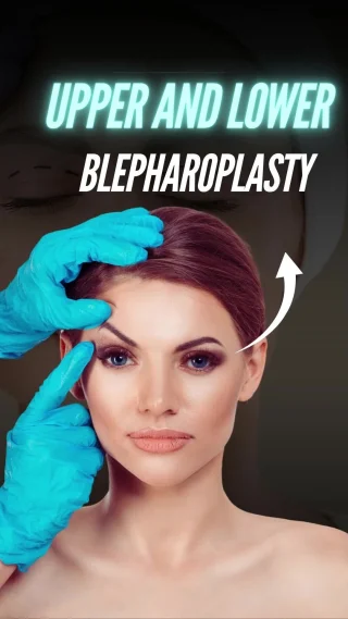 What is Blepharoplasty & How is it Performed? 👁️✨

Dr. Moein explains blepharoplasty, also known as eyelid surgery — a procedure designed to remove excess skin, fat, or muscle around the eyes that can cause drooping lids or puffiness. The result? A fresher, more youthful, and natural look.
🔹 How it’s done:

 – Careful markings are made along natural eyelid creases
 – A small incision is created to remove or reposition excess tissue
 – The incision is closed with fine sutures, leaving minimal scarring

Blepharoplasty can be performed under local anesthesia with sedation or general anesthesia, depending on the case. With precise technique, Dr. Moein restores a brighter, more rested appearance while keeping results natural.

📲 DM us “EYES” to learn more or schedule your consultation.

#DrMoein #Blepharoplasty #EyelidSurgery #CosmeticSurgery #FacialRejuvenation