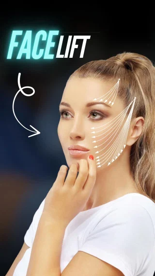What is a Facelift & How is it Performed? ✨👩‍⚕️

In this detailed 3D video, Dr. Moein explains facelift surgery — a procedure designed to lift and tighten sagging skin, reduce deep wrinkles, and restore a youthful, natural appearance.

🔹 In the 3D walkthrough, you’ll see:
 – How the face is carefully marked for treatment
 – Small, discreet incisions placed along the hairline and around the ears
 – Gentle lifting and repositioning of underlying facial muscles
 – Removal of excess, sagging skin for a smoother look
 – Sculpting of the jawline and cheeks for balanced, natural contours

This procedure can be performed under local anesthesia with sedation or general anesthesia. With advanced techniques, Dr. Moein achieves refreshed, natural-looking results — never overdone — helping patients look as young as they feel.

📲 DM us “FACE” to learn more or schedule your consultation.
