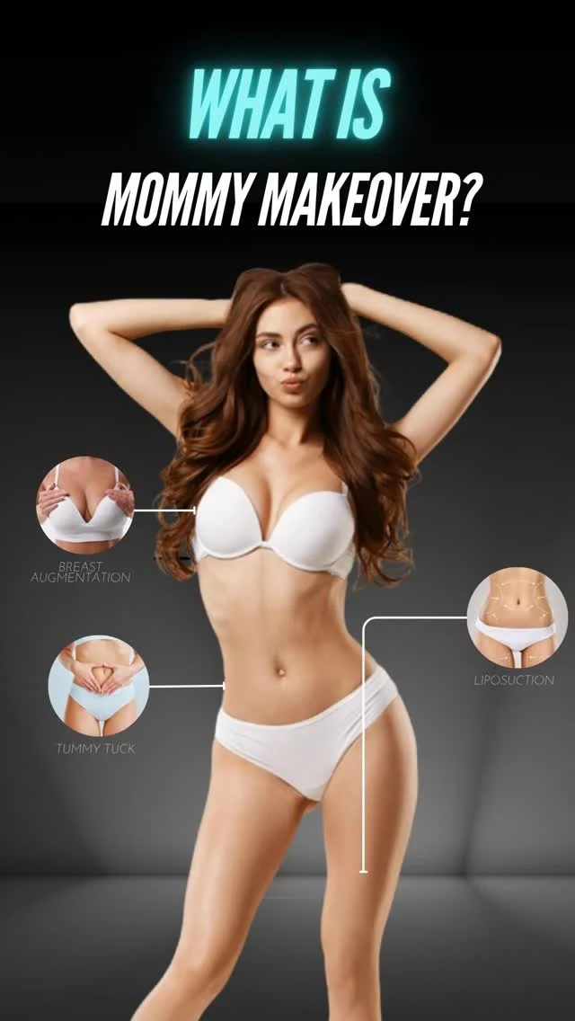 What is a Mommy Makeover? 💡

In this informative video, Dr. Moein explains what a Mommy Makeover is — a customized combination of cosmetic procedures designed to restore a woman’s body after pregnancy, childbirth, and breastfeeding.

From tummy tuck and breast lift to liposuction and body contouring, a Mommy Makeover helps women regain their pre-baby shape, boost confidence, and feel more like themselves again.

📲 DM us “MOMMY” to learn more or schedule your consultation.