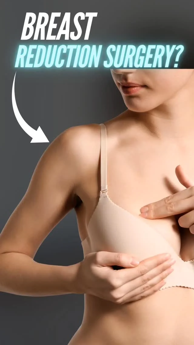 Breast Reduction Surgery 💡

In this 3D visual walkthrough, Dr. Moein demonstrates how Breast Reduction Surgery reduces excess breast tissue and reshapes the breasts for a lighter, lifted, and more balanced look.

Watch how the procedure:

Removes extra tissue and skin

Repositions the nipple and areola

Creates a naturally proportioned breast shape

✨ This animation is designed to help you clearly understand how the surgery works and what kind of results you can expect.

📲 DM “REDUCTION” to learn more or schedule your private consultation.