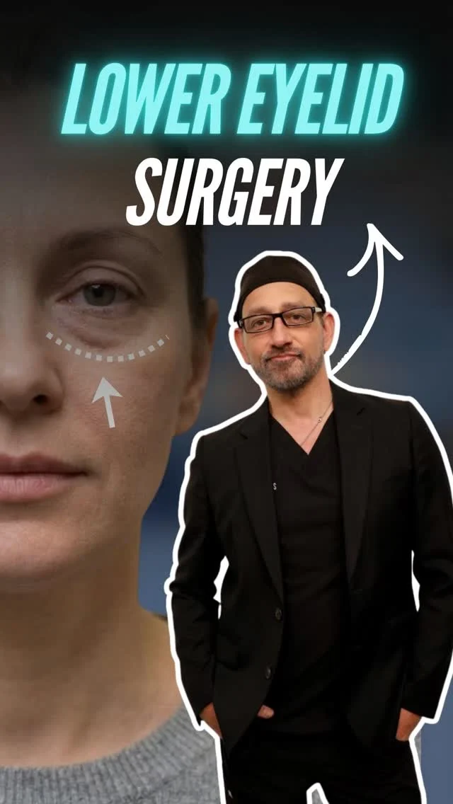Lower Eyelid Surgery 💡

In this 3D visual walkthrough, Dr. Moein demonstrates how Lower Eyelid Surgery removes puffiness and excess fat beneath the eyes to create a smoother, more refreshed, and youthful under-eye appearance.

Watch how the procedure:
Reduces or repositions excess under-eye fat
Tightens or removes loose skin
Smooths the under-eye contour for a rested look

✨ This animation is designed to help you clearly understand how the surgery works and what kind of results you can expect.

📲 DM “EYELIDS” to learn more or schedule your private consultation.
