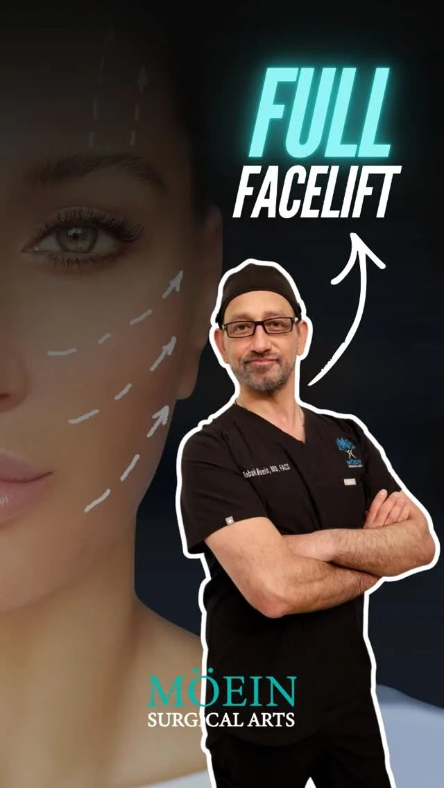 What is a Full Facelift?

In this 3D video, Dr. Moein walks you through how a Full Facelift works, showing the facial layers involved and how aging changes the face over time.

 • Lifts and repositions deeper facial tissues
 • Smooths wrinkles in the mid and lower face
 • Restores youthful contours while maintaining natural facial expressions

✨ This video is designed to give you a clear, visual understanding of the full facelift procedure, how it’s performed, and the kind of natural, balanced results you can realistically expect.

📲 DM “FACELIFT” to learn more or book your private consultation.