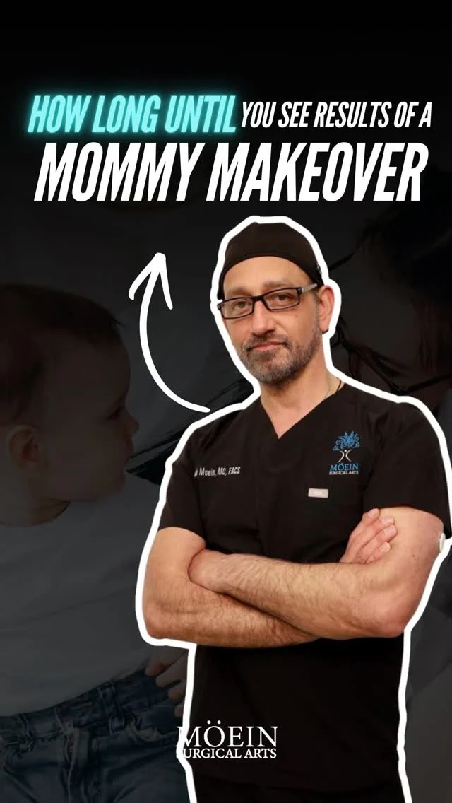 How Long Until You See the Results of a Mommy Makeover? 

A Mommy Makeover is a customized combination of procedures designed to restore your body’s natural contours — all within a single surgical plan and recovery period. Many patients begin noticing visible improvements within just a few weeks.

✨ Why patients choose a Mommy Makeover:
✔️ One carefully planned surgery
✔️ A single recovery timeline
✔️ A firmer, flatter abdominal profile
✔️ Restored breast shape and volume
✔️ A more sculpted, balanced silhouette

🪄 Your personalized plan may include:
• Abdominoplasty to remove excess skin and tighten separated abdominal muscles
• 360° liposuction to refine the waistline and flanks
• Breast lift and/or augmentation to restore youthful contour
• Optional fat transfer to enhance natural curves

This comprehensive approach is designed not just to reshape your body — but to help you feel confident, comfortable, and empowered in your own skin again.

📲 Send us a message to learn whether a Mommy Makeover is right for you
📞 (310) 861-3176
🌐 moeinsurgicalarts.com
📧 appointment@msurgicalarts.com

#DrMoein #MommyMakeover #LosAngelesPlasticSurgery #BodyContour #ConfidenceRestored