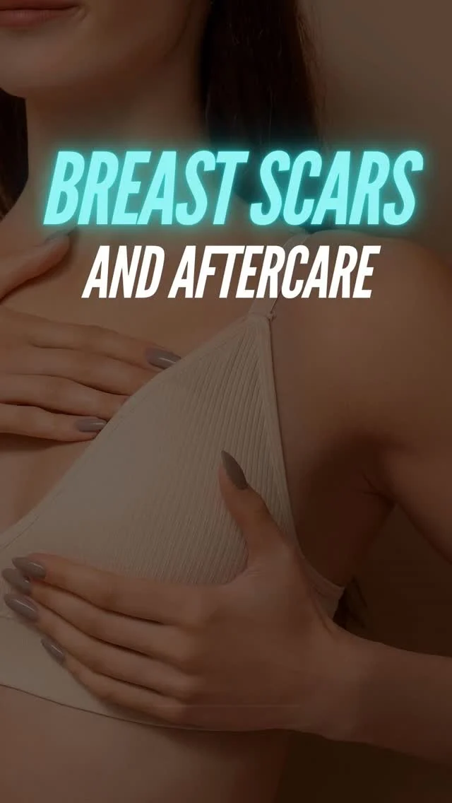 Breast Reduction | Incisions & Scar Care Explained

Thinking about breast reduction? It’s more than a cosmetic change — it can bring lasting relief from back, neck, and shoulder pain, improve posture, and create beautiful, balanced body proportions.

Here’s what to know about the procedure and healing process:
✂️ Common Incision Techniques
🔹 Anchor (Inverted-T)
Around the areola, vertically down the breast, and along the crease.
Ideal for significant reduction and maximum reshaping.
🔹 Lollipop Incision
Around the areola and vertically downward.
Perfect for moderate reductions with excellent contouring.
🔹 Donut Incision
Around the areola only.

Best for smaller reductions or subtle lifting.
🩹 Scar Care for Beautiful Healing

After surgery, proper care helps scars fade and soften over time.
✔ Silicone gel or silicone sheets to support scar fading
✔ Gentle massage (once approved by your surgeon) to improve healing
✔ Sun protection to prevent darkening of scars
✔ Laser treatments to reduce redness and refine texture
✔ Microneedling to boost collagen and improve skin quality

Every treatment plan is customized for your body and healing process, ensuring results that look natural, balanced, and confident.

📲 DM for a private consultation
📞 (310) 861-3176
🌐 Moeinsurgicalarts.com
📧 appointment@msurgicalarts.com

#DrMoein #BreastReduction #ScarCare #PlasticSurgery #AestheticSurgery