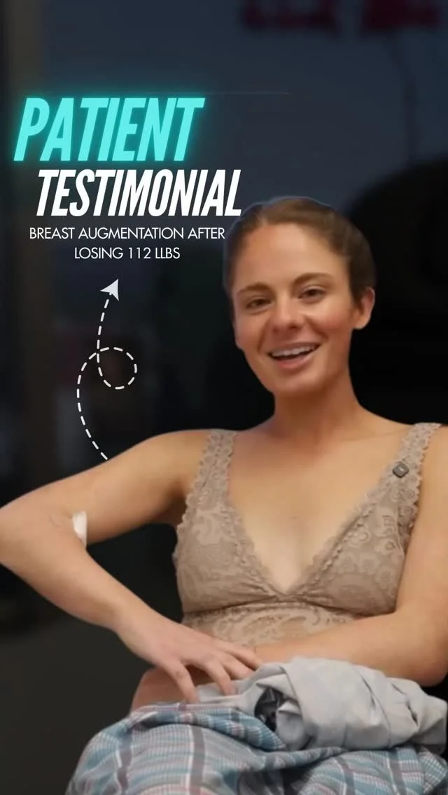 After losing over 100 pounds and completing her gastric sleeve and tummy tuck, this was the final step in her transformation at Moein Surgical Arts. 🤍
This young female patient worked incredibly hard to achieve her weight-loss goals, and breast augmentation became the final piece in restoring balance, shape, and confidence to match her new body.

At Moein Surgical Arts, procedures like these are designed to help patients complete their transformation journey with natural-looking, harmonious results.

📲 DM us
📞 (310) 861-4093
🌐 moeinsurgicalarts.com
📧 Appointment@msurgicalarts.com
•
•
#BodyLift #BodyContouring #BodyTransformation #SkinTightening #LowerBodyLift