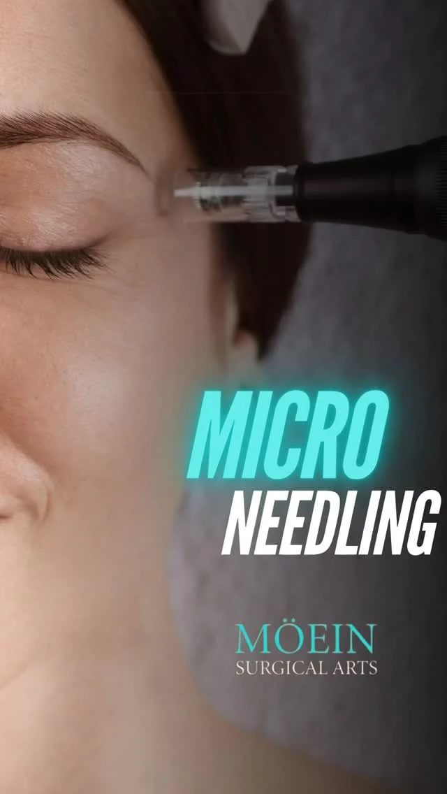 What is Microneedling?

In this 3D explainer video, Dr. Moein explains what microneedling is and how it helps improve skin texture, boost collagen production, and enhance overall skin health.

✨ This 3D educational video helps you clearly understand the microneedling process and what kind of results you can realistically expect.

📲 DM “SKIN” to learn more or schedule your private consultation.

#drmoein #microneedling #beverlyhills #moeinsurgicalarts