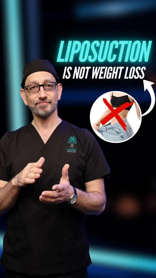 Liposuction is not designed for weight loss — it’s designed for body contouring.

The goal isn’t simply to remove fat from one area, but to create balance, proportion, and a more sculpted silhouette. That’s why liposuction is often performed with a 360° approach to ensure natural-looking results.

Best suited for patients near their ideal weight who struggle with stubborn fat that doesn’t respond to diet or exercise.

✨ Refined contours. Natural definition. Balanced results.
📲 DM us for a consultation
🌐 moeinsurgicalarts.com

#drmoein #liposuction #bodycontouring #plasticsurgery