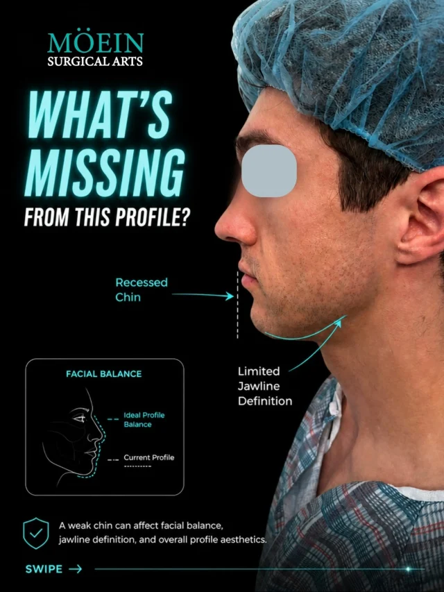 Chin Implant Surgery ✨

Not every transformation is about looking dramatically different… Sometimes, it's about creating balance, harmony, and confidence in your natural features.
This case focused on enhancing chin projection, improving facial proportions, and creating a more defined profile that complements the rest of the face.

Think:
✨ Improved facial balance and symmetry
✨ Stronger, more defined jawline appearance
✨ Enhanced side profile and chin projection
✨ Greater confidence in photos and everyday life

A Chin Implant isn't about changing who you are. It's about refining your natural features and helping you feel more confident in your appearance. ✨
Functional harmony meets aesthetic refinement.

💬 Real question: What's one facial feature you'd love to enhance—not for anyone else, but purely for yourself? (Comment below—we'll personally guide you 👇)

📍 Moein Surgical Arts 📲 DM "PROFILE" for a private consultation
.
.
#ChinImplant #FacialHarmony #ProfileEnhancement #PlasticSurgery #FacialBalance #CosmeticSurgery #ConfidenceBoost #BeforeAndAfter
