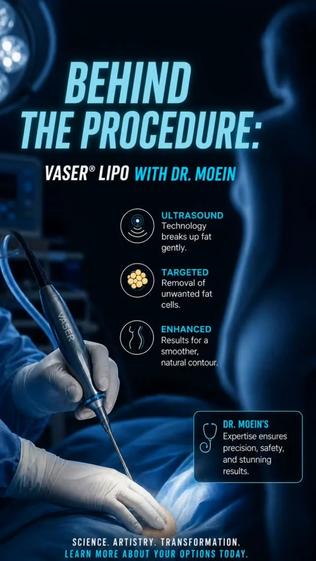 🎥 Behind the Scenes: VASER Liposuction with Dr. Moein** ✨

Step inside the operating room and see how precision meets artistry. Behind every incredible transformation is careful planning, advanced technology, and meticulous attention to detail.

VASER Liposuction uses ultrasound-assisted technology to gently target and remove unwanted fat while helping sculpt smooth, natural-looking body contours. Every step is performed with safety, precision, and aesthetic balance in mind.

✨ Advanced VASER technology
✨ Precision body sculpting
✨ Smooth, natural-looking contours
✨ Personalized treatment for every patient

This is more than fat removal—it's about creating balanced, refined results that complement your natural anatomy.

💬 What would you like to see more of behind the scenes? Let us know in the comments below! 👇

📍 Moein Surgical Arts
📲 DM **"VASER"** to learn more or schedule your private consultation.
.
.
#VASERLiposuction #BehindTheScenes #BodyContouring #Liposuction #moeinsurgicalarts