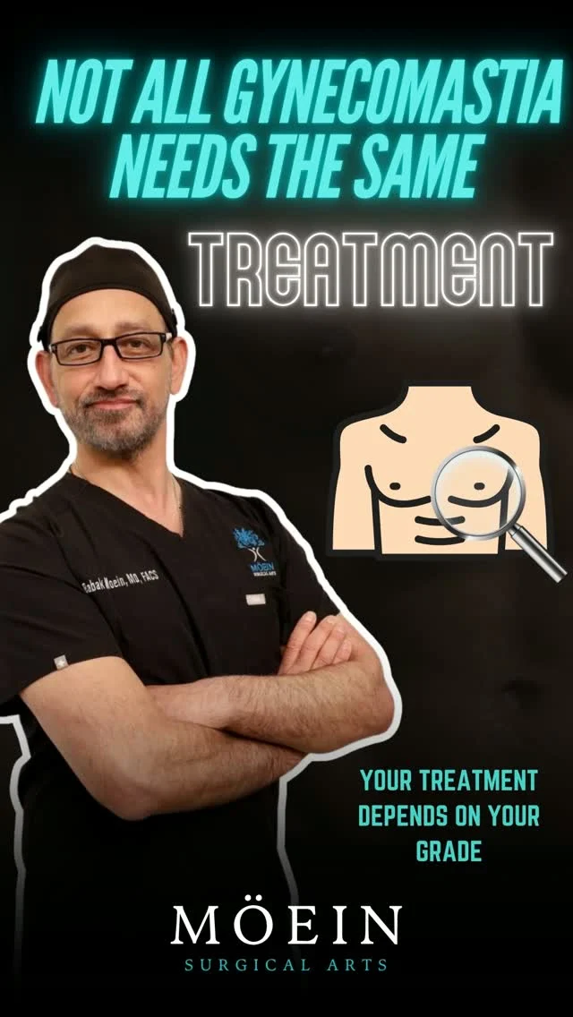 Gynecomastia Treatment Options 🤔

Not all gynecomastia requires the same treatment. The right approach depends on fat, glandular tissue, excess skin, and your goals.

🔹 Liposuction — Removes excess fat
 🔹 Gland Removal — Removes excess breast tissue
 🔹 Skin Excision — Addresses significant loose skin
 🔹 Combination Treatment — May combine techniques for a more defined chest

✨ Every case is different. An expert evaluation helps determine the right approach for you.
📍 Moein Surgical Arts
 📲 DM “GYNECOMASTIA” for a private consultation.

#Gynecomastia #GynecomastiaSurgery #MensHealth #ChestContouring