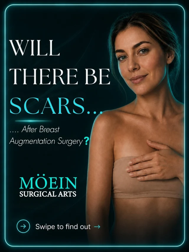 Will There Be Scars After Breast Augmentation Surgery? ✨

One of the most common questions patients ask before breast augmentation is: “Will I have scars?”

The answer is yes—but the goal is to make them as discreet and minimal as possible.
✨ Incisions are carefully planned based on your anatomy
✨ Incisions are typically placed in discreet locations
✨ Scars gradually fade and mature over time
✨ Proper aftercare can support healthy scar healing
✨ Every patient’s healing process is different
✨ Your surgeon will discuss the incision options best suited to you

The goal? Beautiful, natural-looking results with scars that are as inconspicuous as possible.
💬 Have questions about breast augmentation scars? Drop them below!
📍 Moein Surgical Arts
📲 DM “BREAST AUGMENTATION” to schedule your consultation.

#BreastAugmentation #BreastImplants #BreastAugmentationSurgery #BreastSurgery #PlasticSurgery #MoeinSurgicalArts