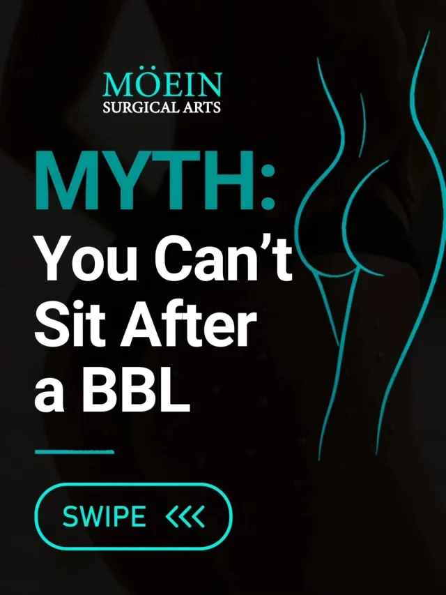 Myth: You Can’t Sit After a BBL? 🍑✨

One of the most common questions patients ask before a Brazilian Butt Lift (BBL) is: “Will I be able to sit after surgery?”

The answer is yes—but you’ll need to follow specific sitting precautions during your recovery.

✨ Sitting directly on the buttocks is typically limited during the early healing period
✨ Your surgeon may recommend using a BBL pillow or specialized cushion
✨ Sitting positions and duration may be gradually increased as healing progresses
✨ Following your surgeon’s post-op instructions is essential
✨ Recovery timelines can vary from patient to patient
✨ Your surgeon will guide you on when and how you can safely resume normal sitting

The goal? Protect your results while giving your body the time it needs to heal properly. 💫

💬 Have questions about sitting after a BBL? Drop them below!

📍 Moein Surgical Arts
📲 DM “BBL” to schedule your consultation.

#BBL #BrazilianButtLift #BBLSurgery #BBLRecovery #moeinsurgicalarts