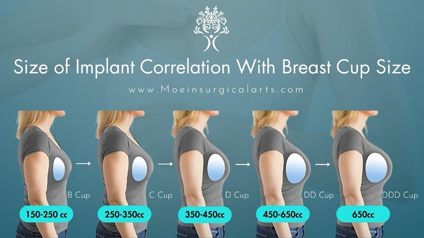 size of implant size of implant
