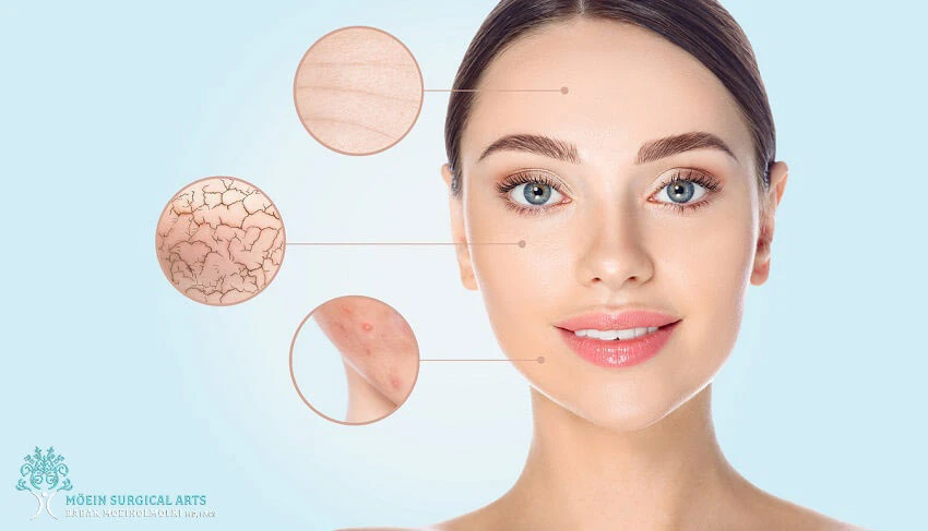 Skin Blemishes Can Be Treated with Microdermabrasion