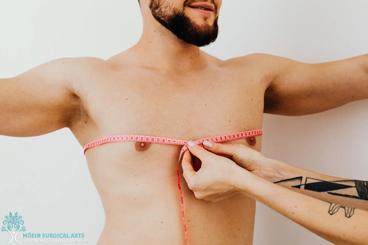 male breast Reduction Techniques