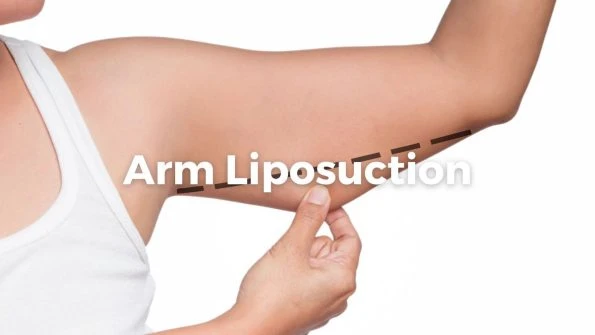 Arm Liposuction