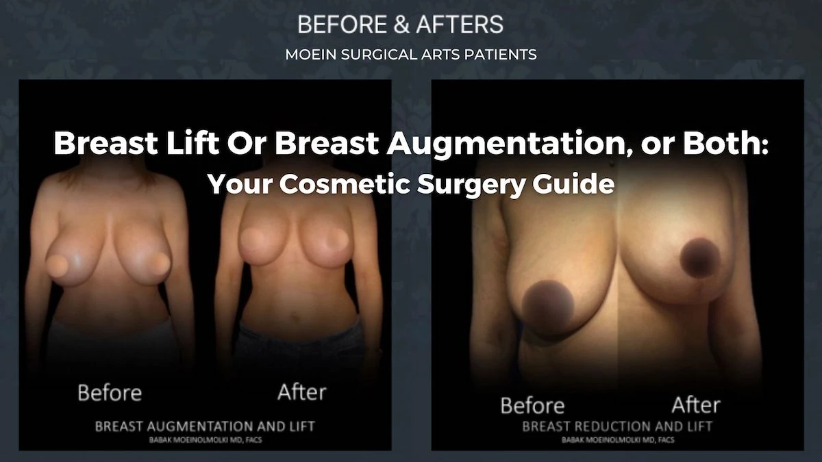 Breast Lift Or Breast Augmentation, or Both