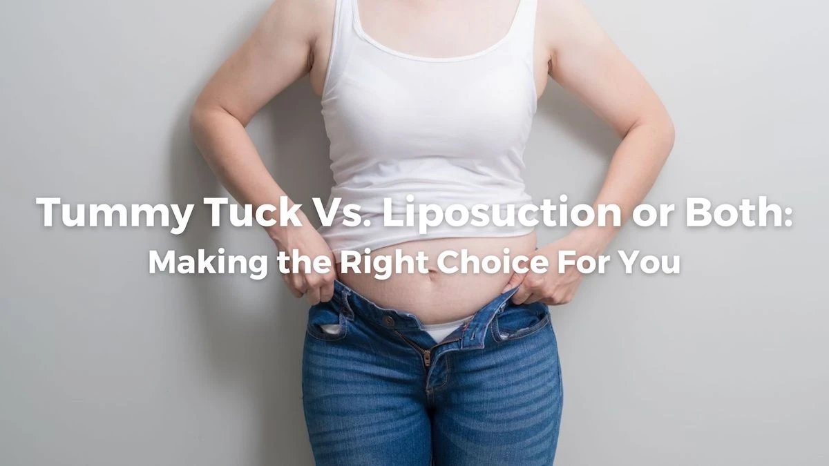 Tummy Tuck Vs. Liposuction or Both: Making the Right Choice For You