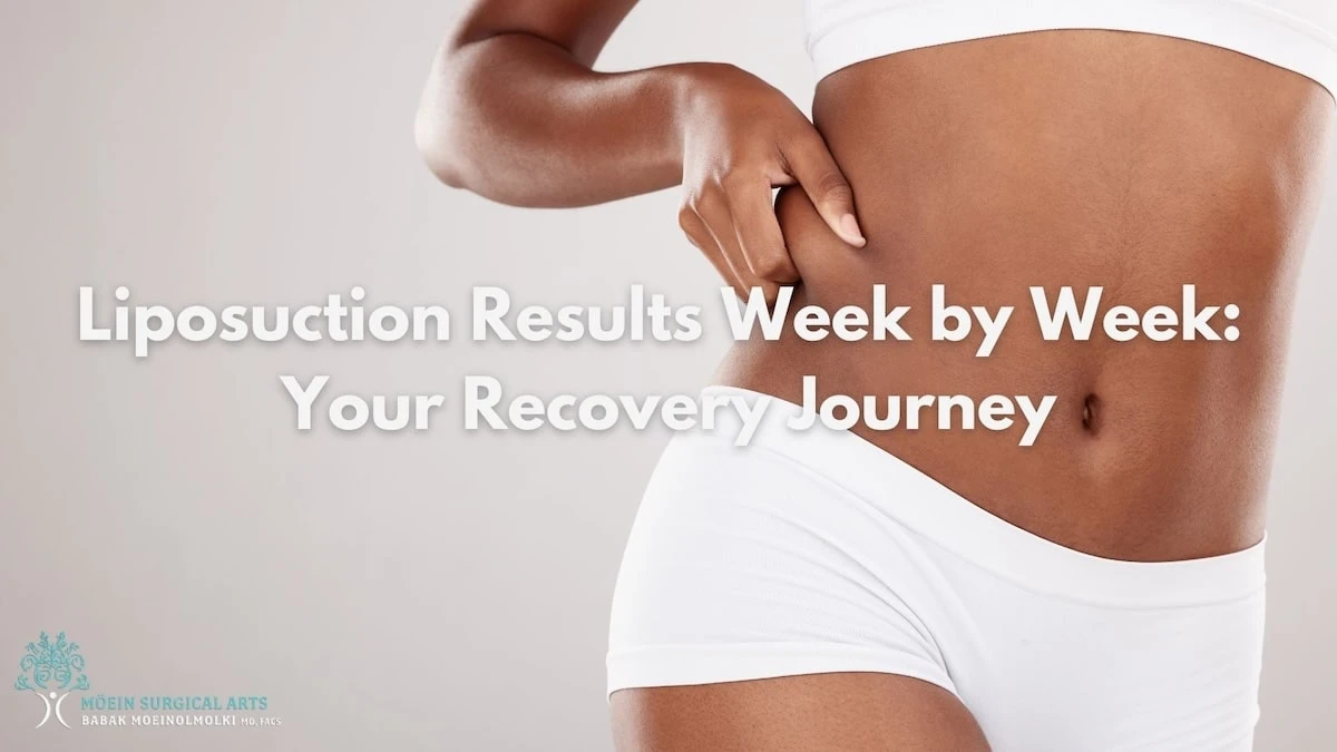 Liposuction Results Week by Week